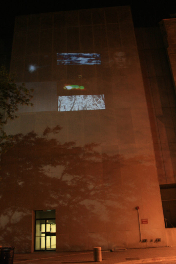 Opening Projection, Surgery - Brain Research Pavilion, University of Chicago, IL, USA, May 11, 2012. 